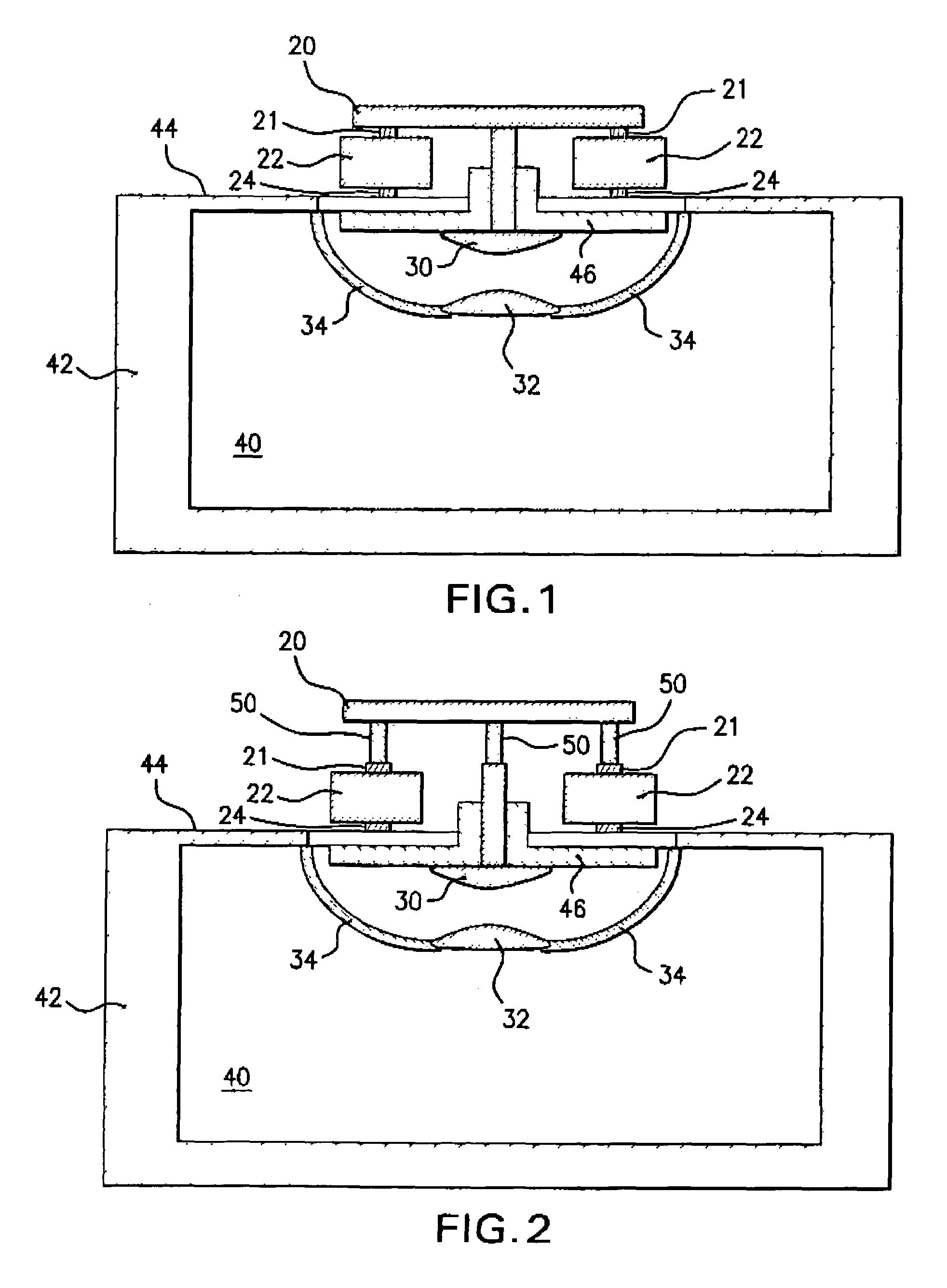 Gas discharge laser output light beam parameter control