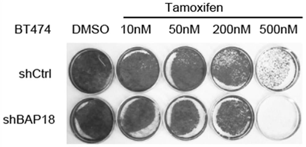 Application of bap18 in breast cancer resistance to endocrine therapy