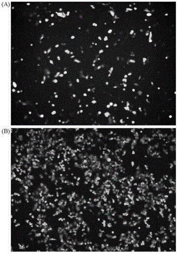 Neutralizing monoclonal antibody in human adenovirus 7 and preparation method and application thereof