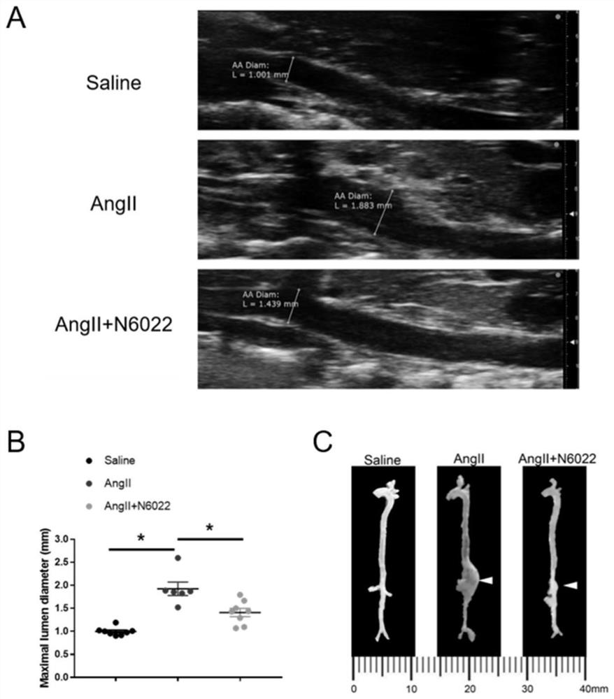 Application of n6022 in the preparation of drugs for preventing and treating aortic dissection and aortic aneurysm