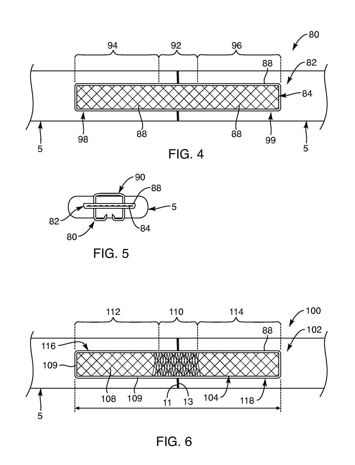 Soft tissue repair devices, systems, and methods