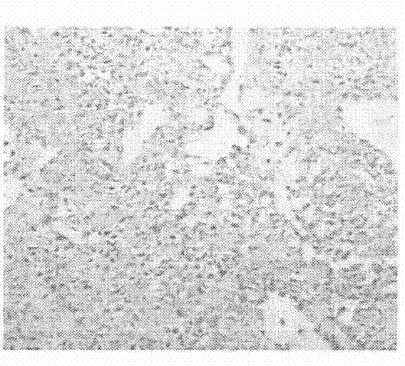 Application of semen astragali complanati general flavone extract in the preparation of pulmonary fibrosis prevention drugs