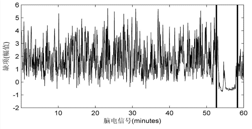 Electroencephalogram classification detection device based on lacuna characteristics