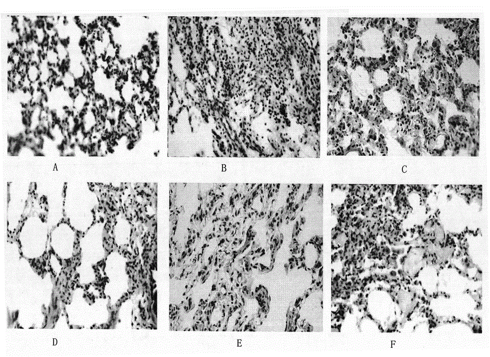 Formononetin derivative, preparation method and application thereof