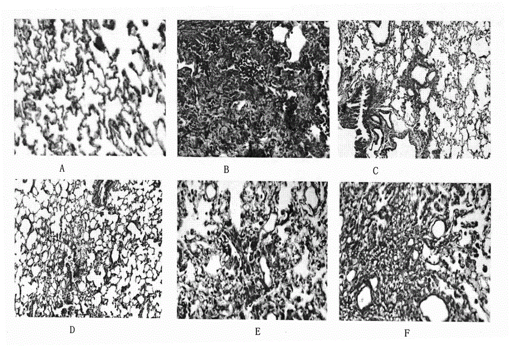 Formononetin derivative, preparation method and application thereof