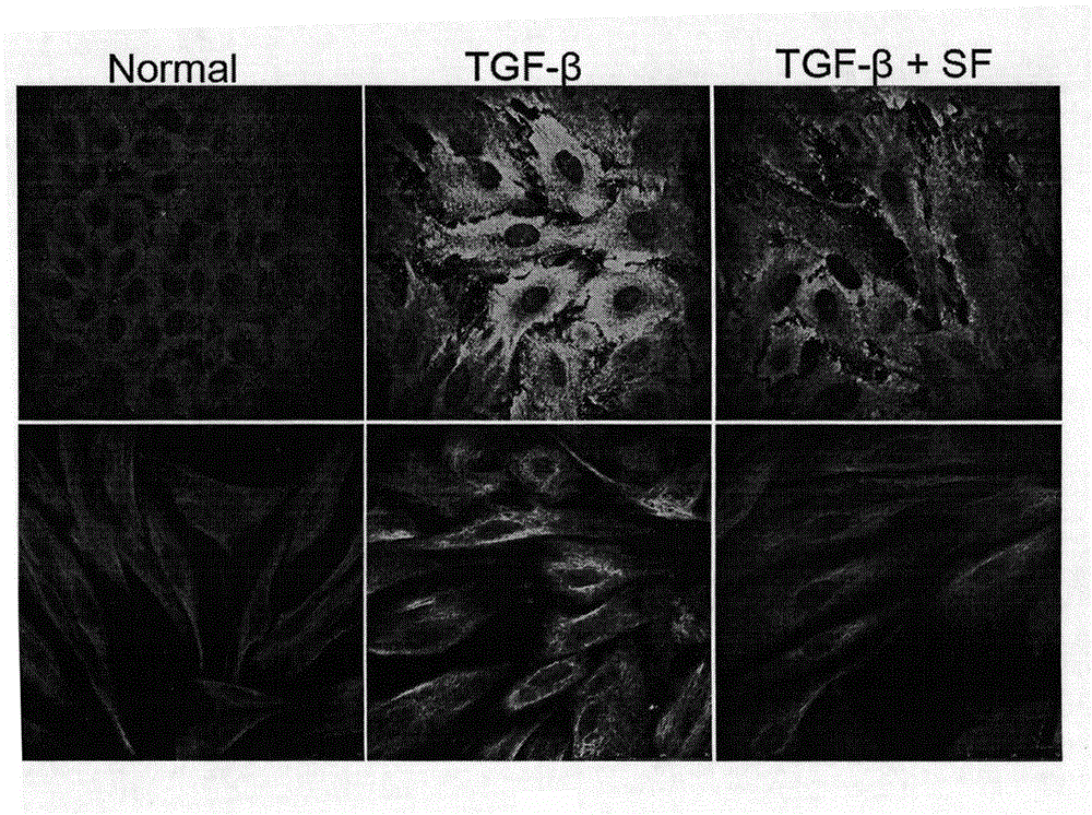 Formononetin derivative, preparation method and application thereof