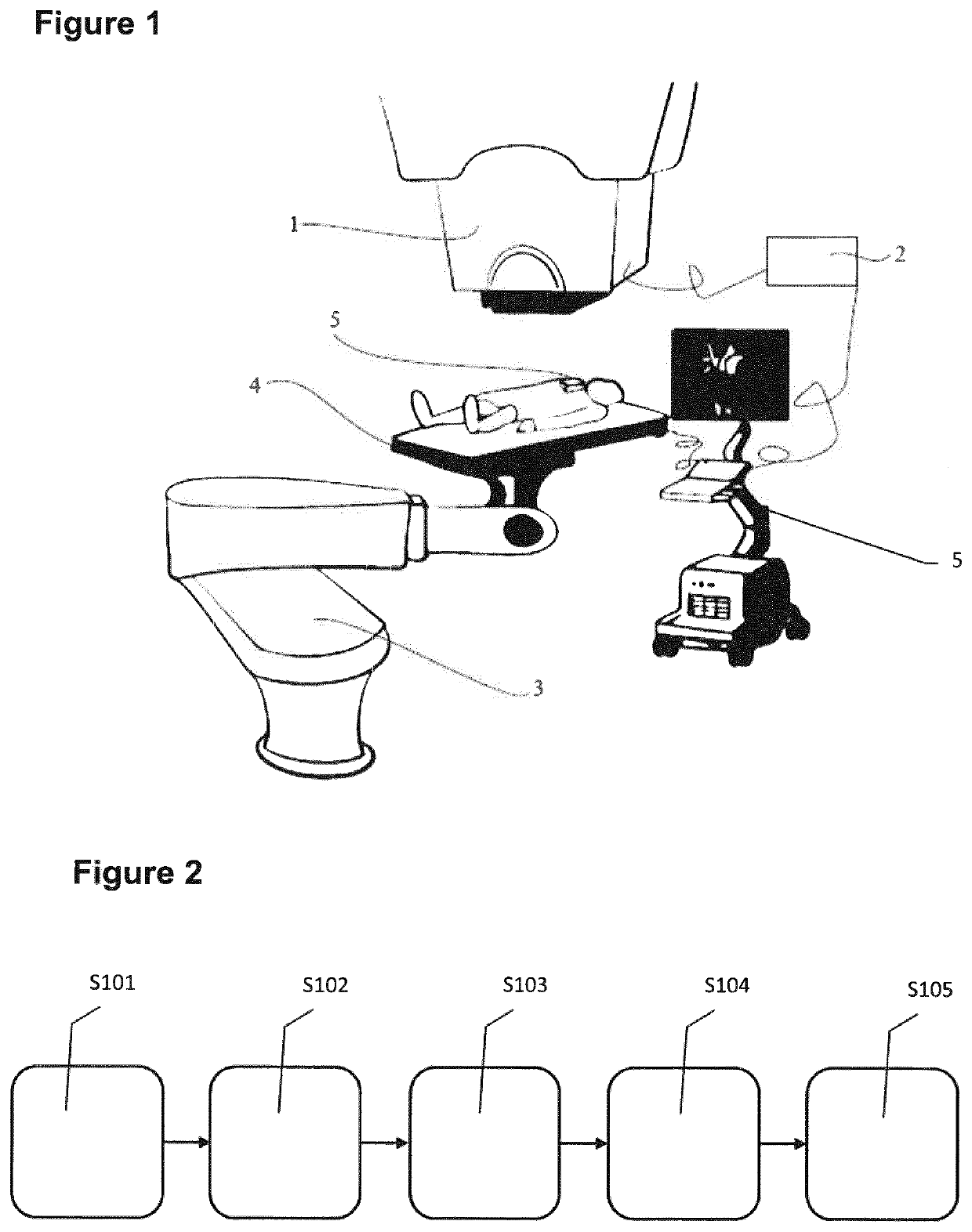 Heart arrhythmia non-invasive treatment device and method