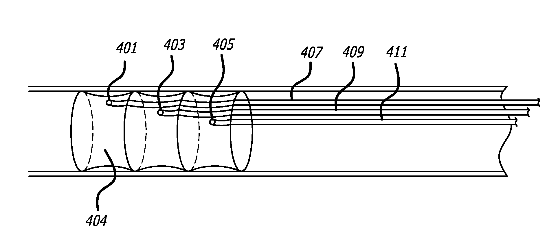 Systems and Methods for Local Bioactive Material Delivery