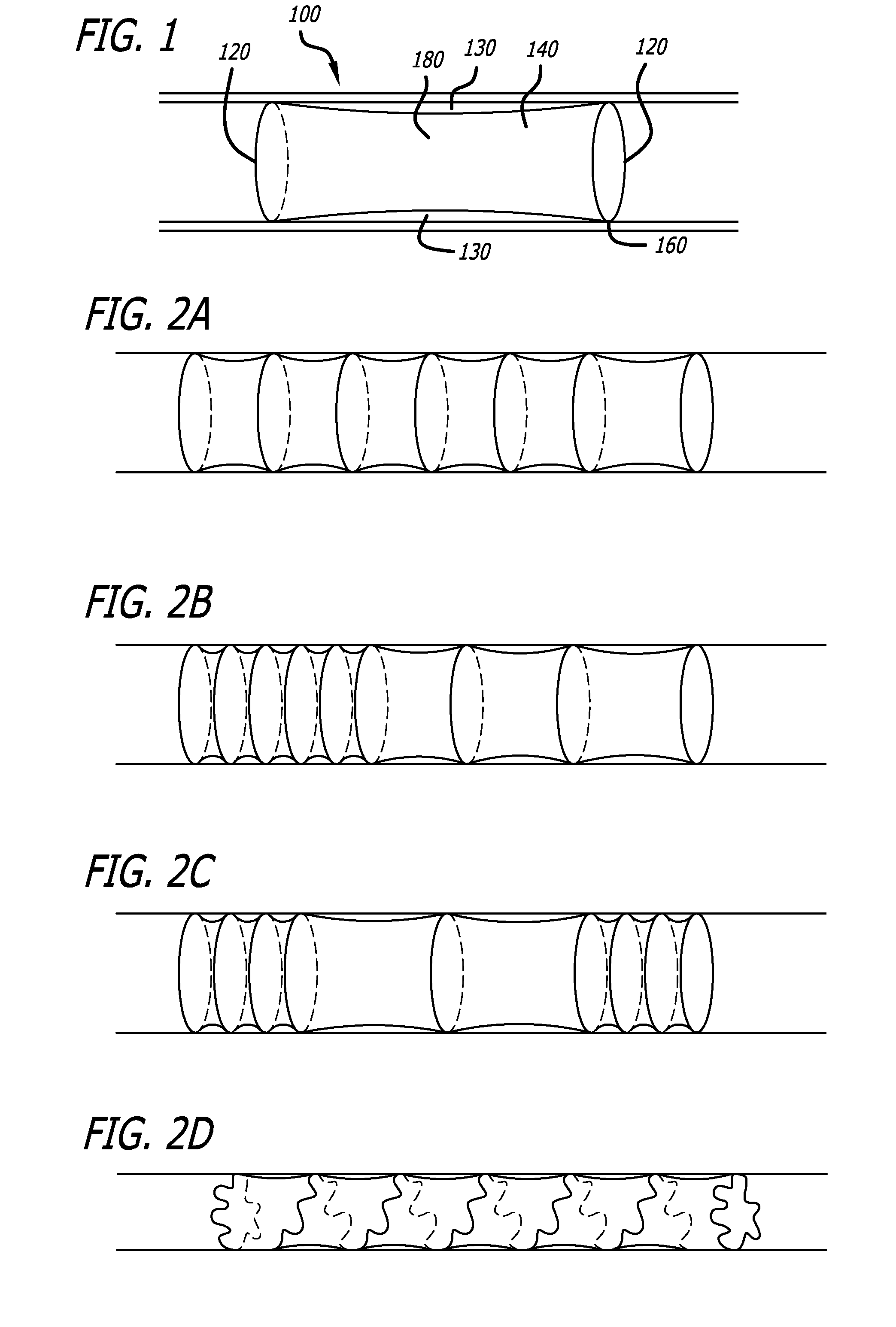 Systems and Methods for Local Bioactive Material Delivery