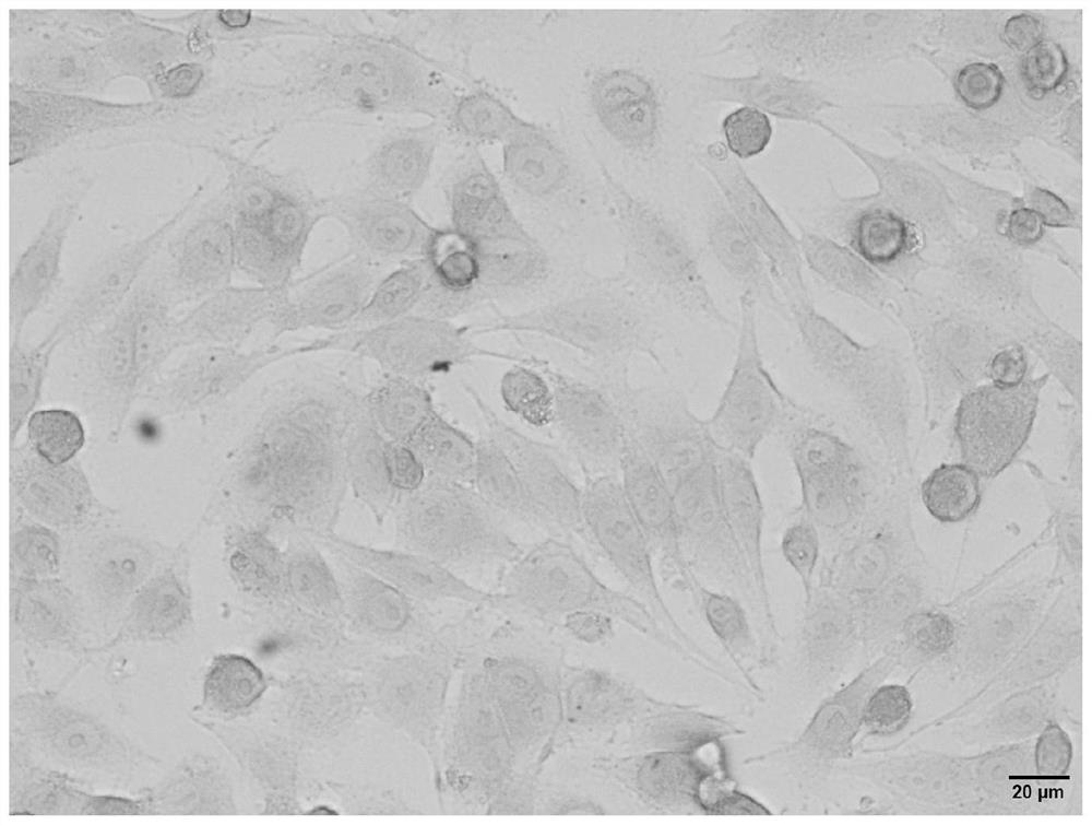 A preparation method of iron oxide nanoparticles and its application in tumor targeted diagnosis and treatment