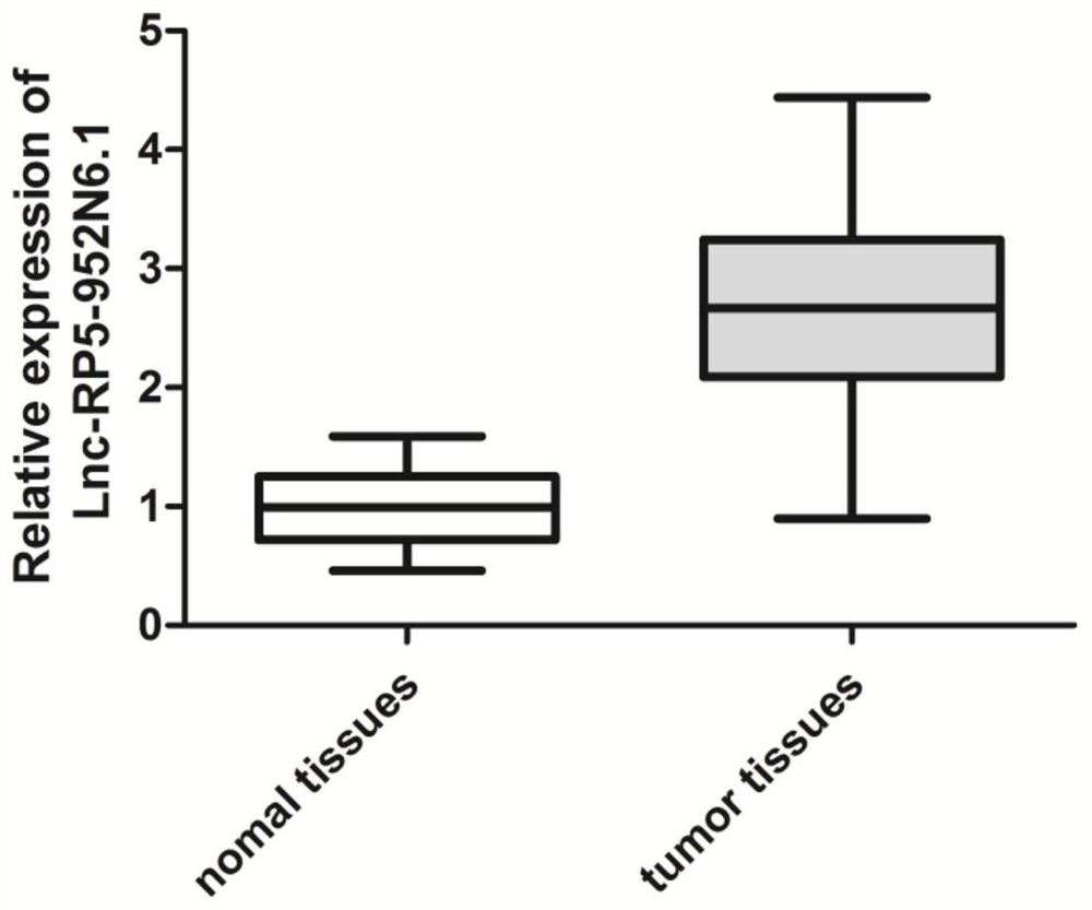 Application of reagent for down-regulating gene expression in preparation of prostatic cancer drugs