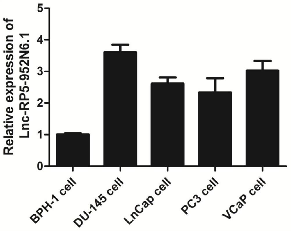 Application of reagent for down-regulating gene expression in preparation of prostatic cancer drugs