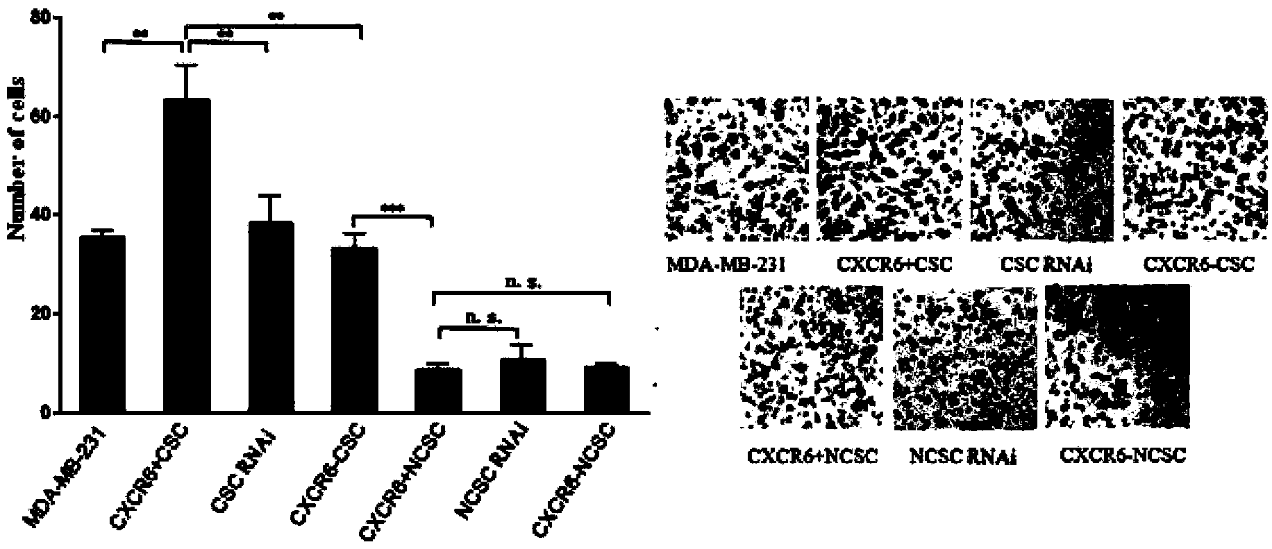 Screening kit of malignant breast cancer stem cells