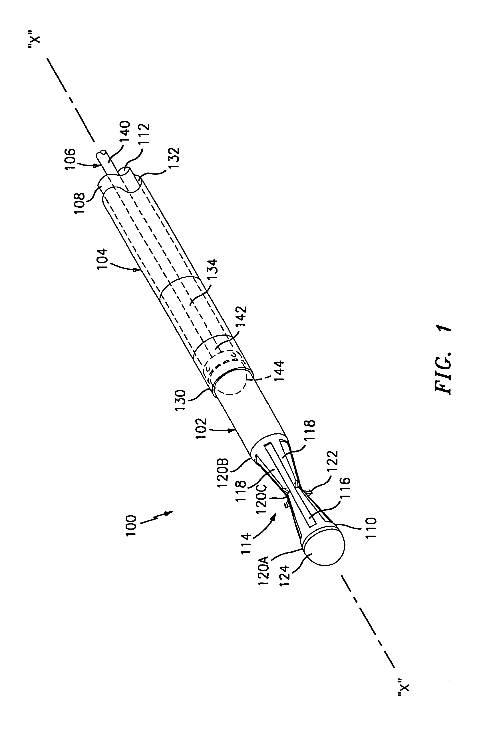 Method and apparatus for anastomosis including an anchoring sleeve