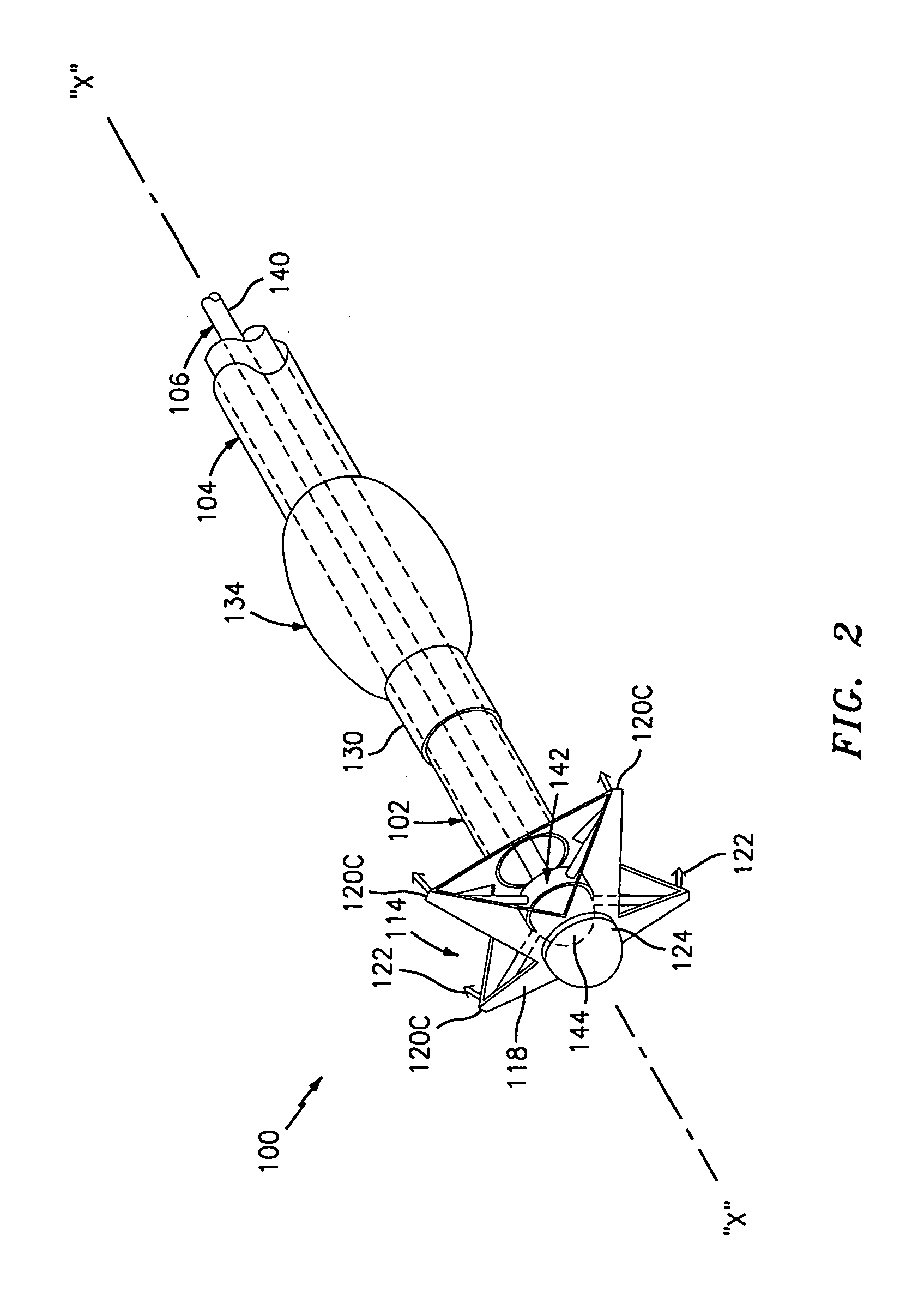 Method and apparatus for anastomosis including an anchoring sleeve