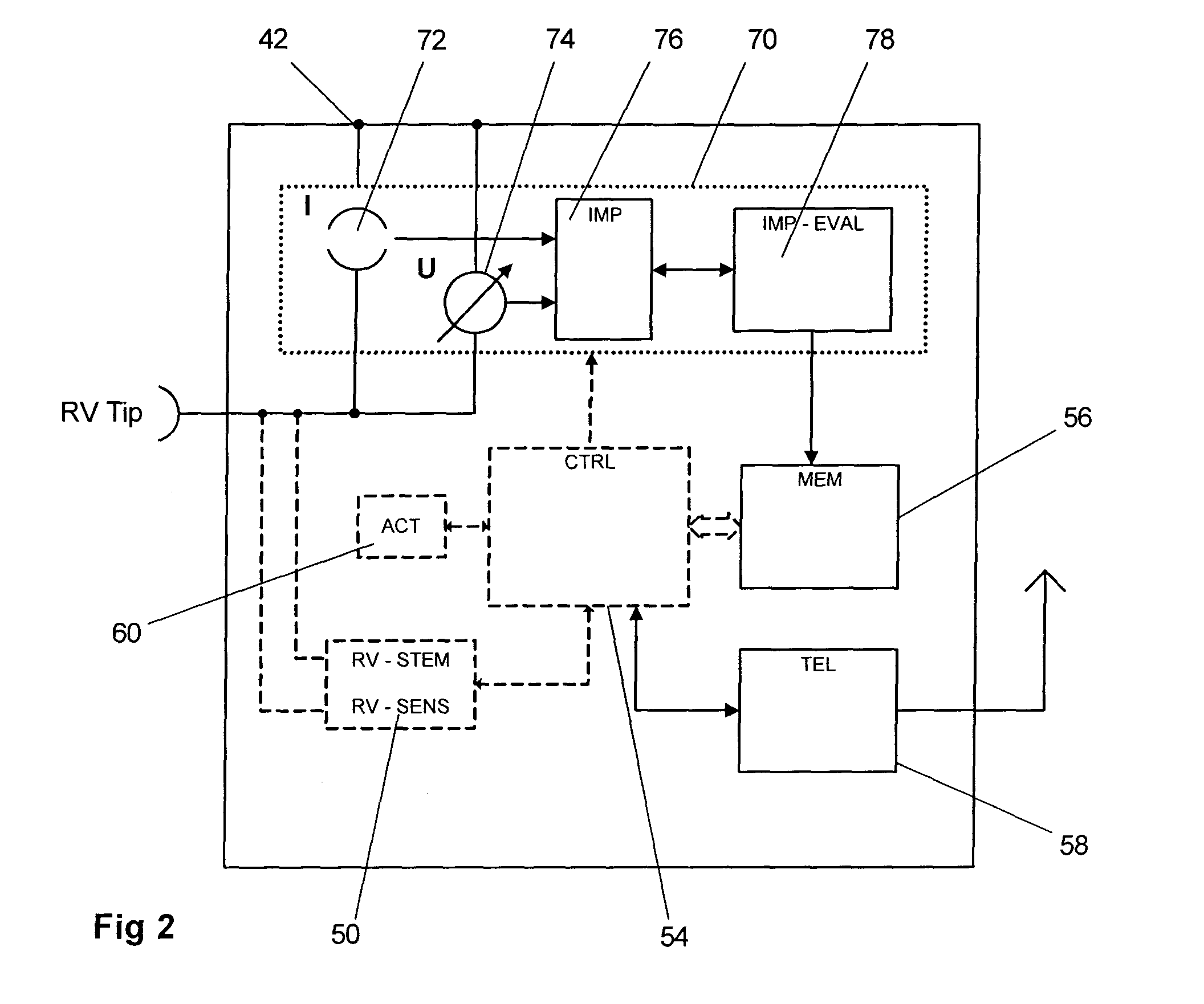 Monitoring system for sleep disordered breathing