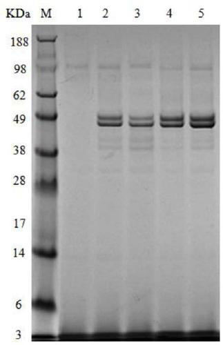 A kind of alkaline pectinase secretion enhanced bacterial strain and its application