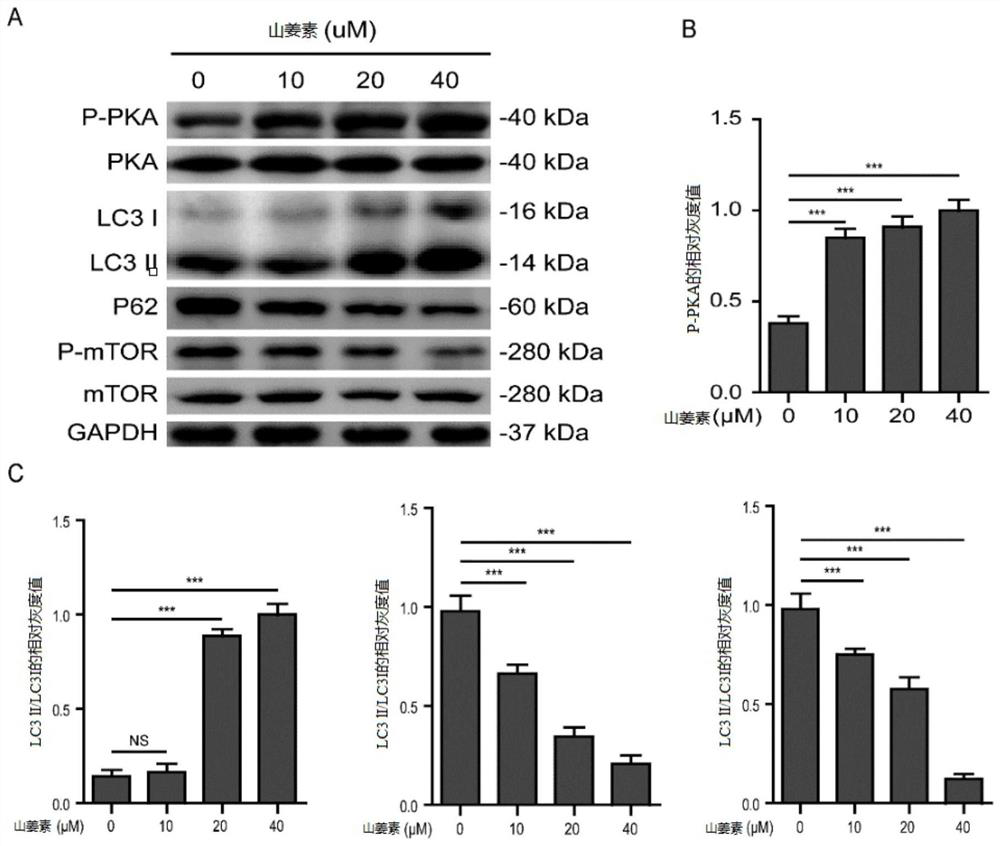 Application of alpinetin in preparation of medicine for preventing and treating osteoporosis