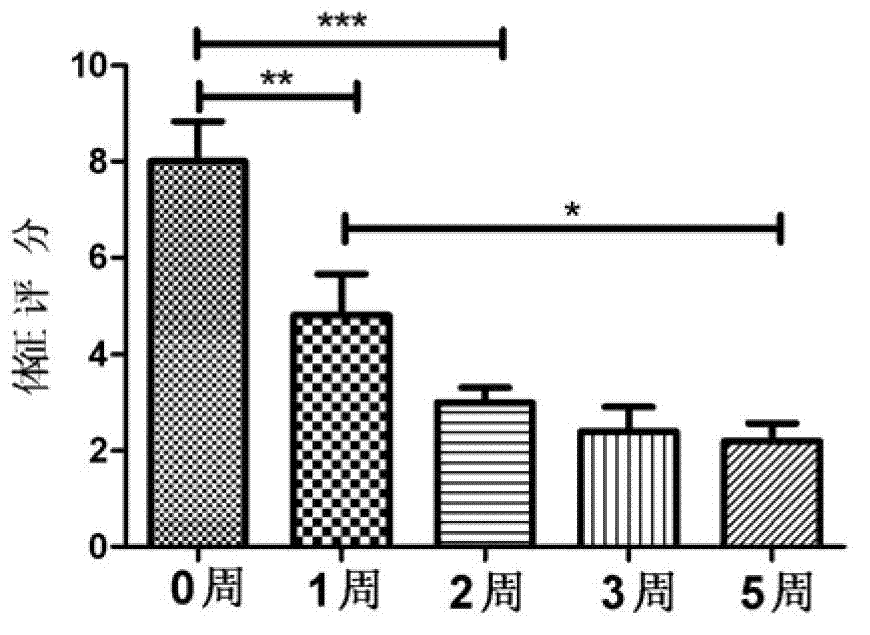 Nitroimidazole oculentum and preparation method thereof