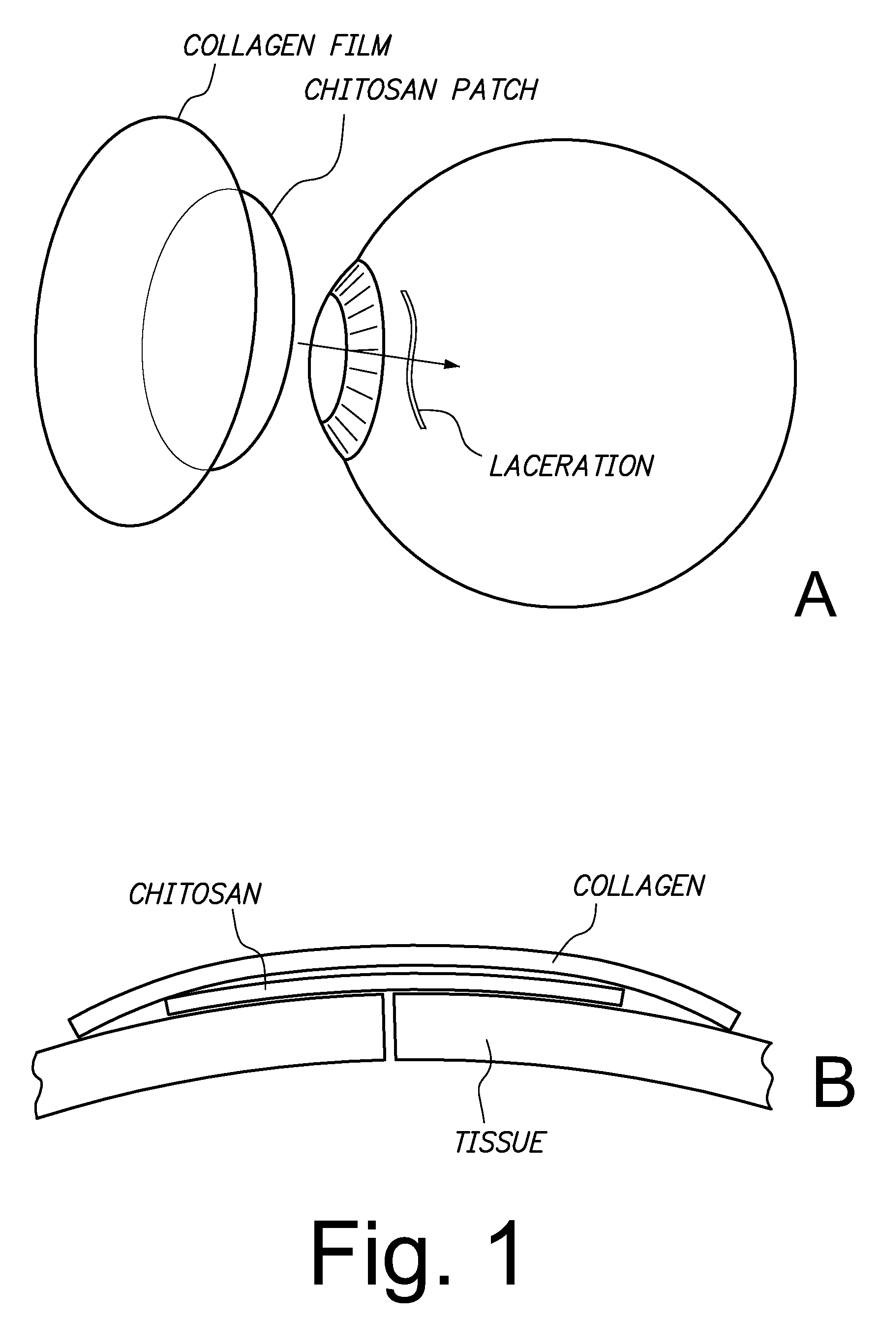 Sutureless methods for laceration closure