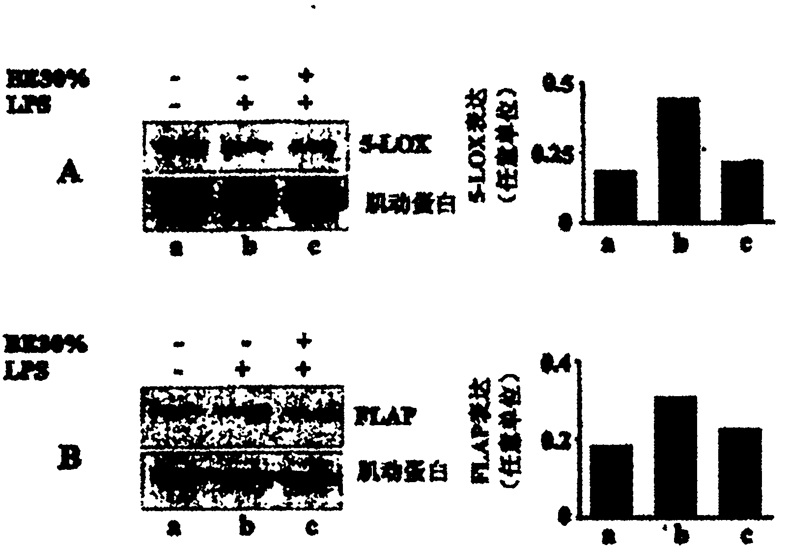 Synergistic anti-inflammatory compositions comprising boswellia serrata extracts