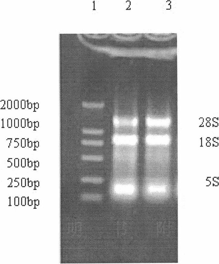 Recombinant large-tooth flounder interleukin-6 protein and preparation method thereof