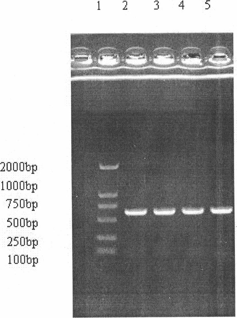 Recombinant large-tooth flounder interleukin-6 protein and preparation method thereof