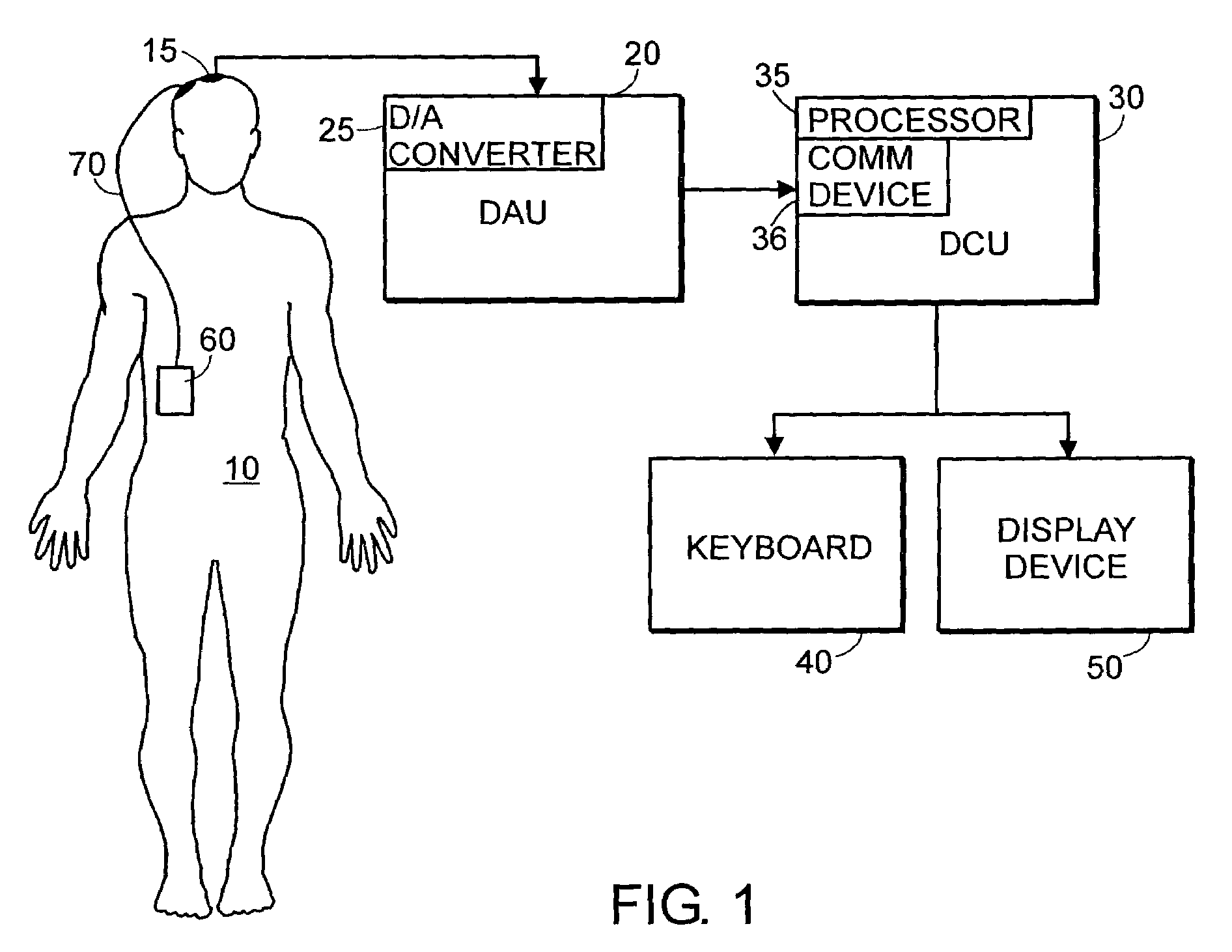 System and method of assessment of the efficacy of treatment of neurological disorders using the electroencephalogram