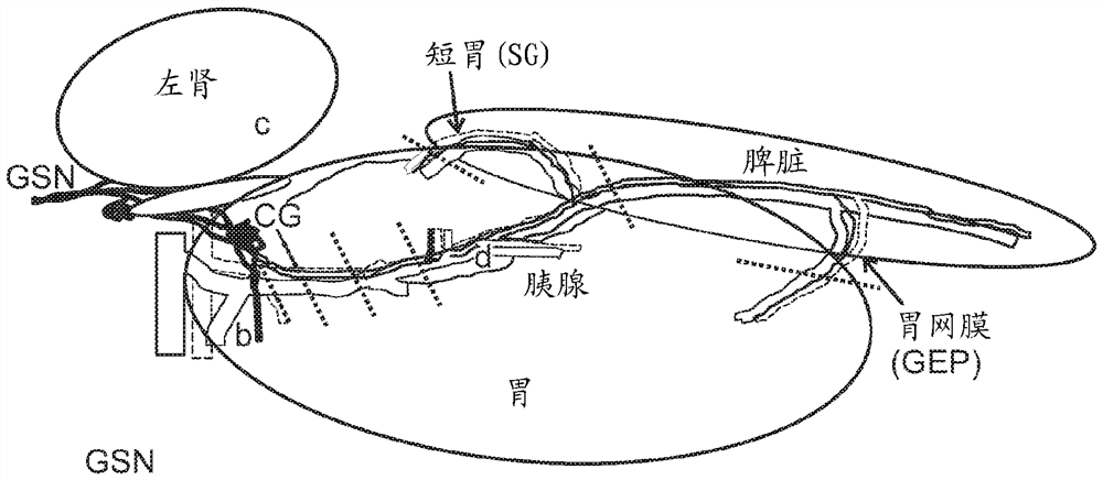 Stimulation of a nerve supplying the spleen