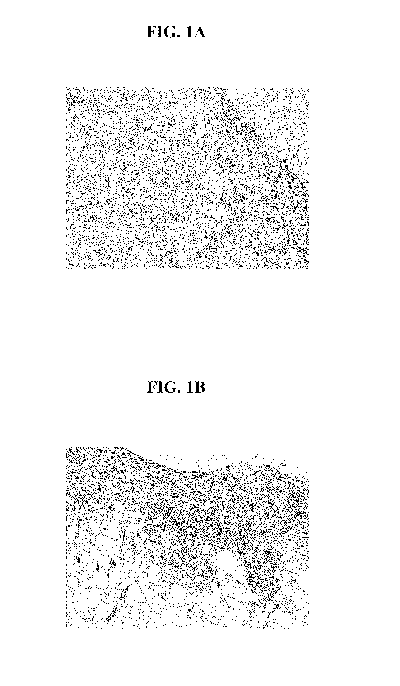 Biocompatible scaffold for ligament or tendon repair