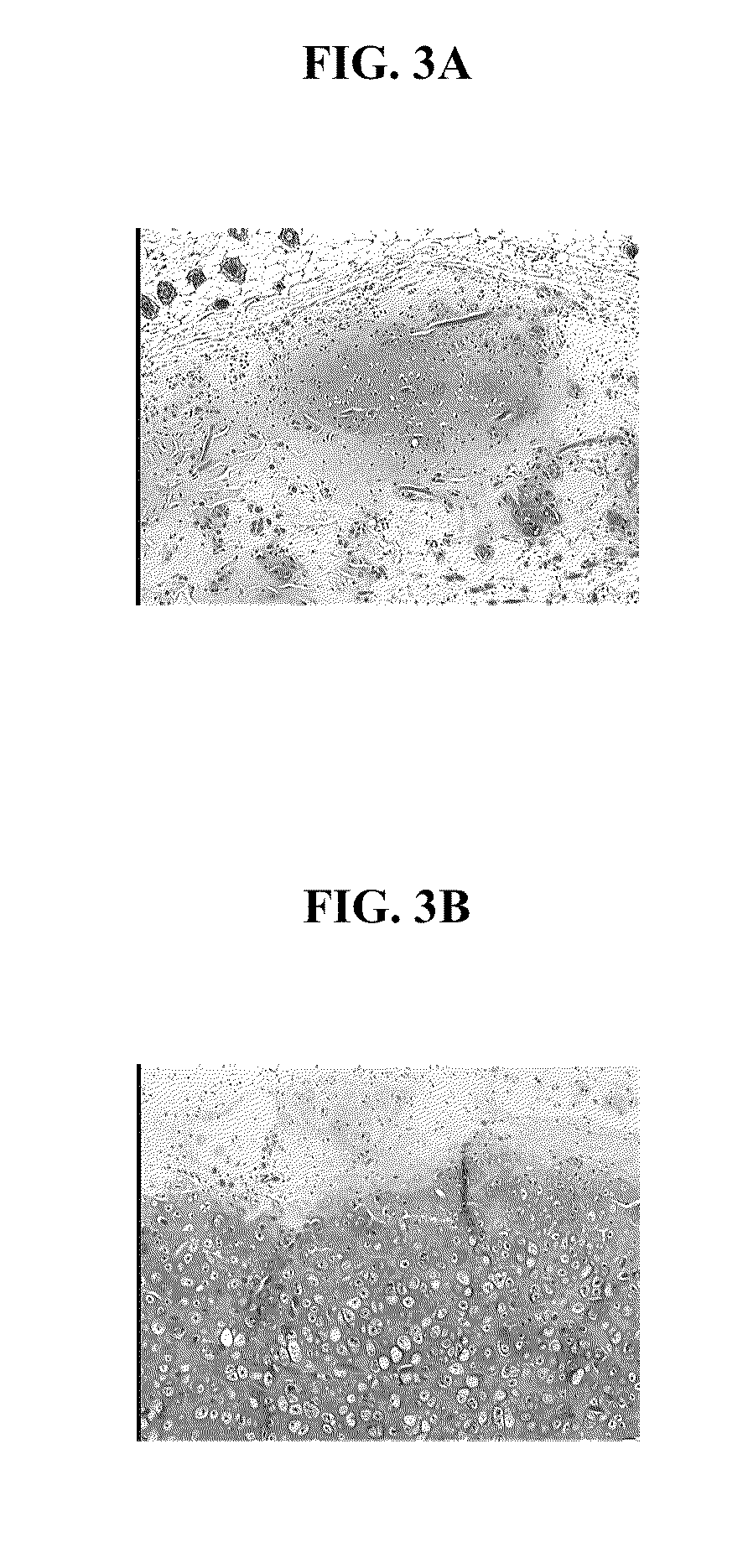 Biocompatible scaffold for ligament or tendon repair