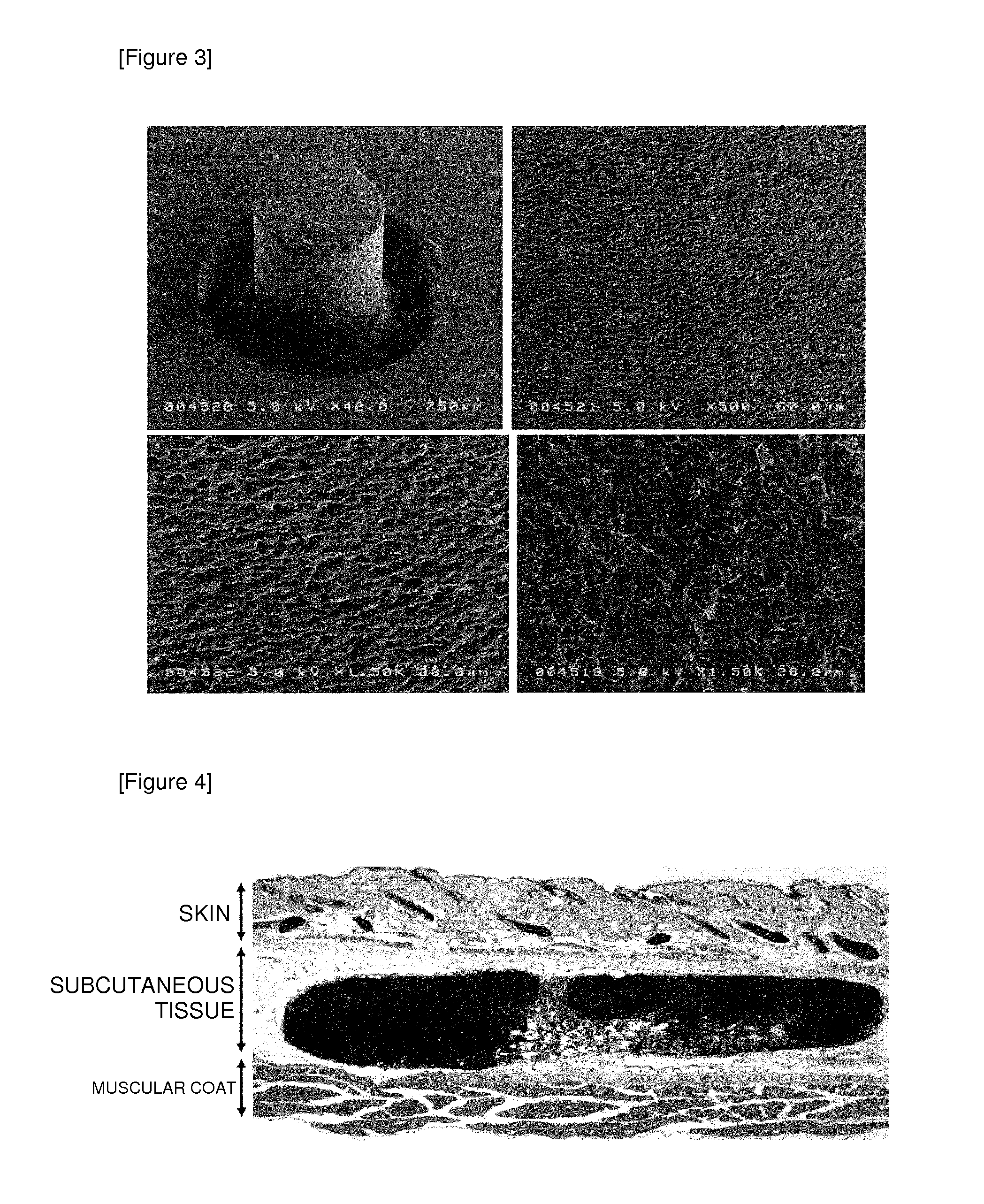 Vaccine adjuvant