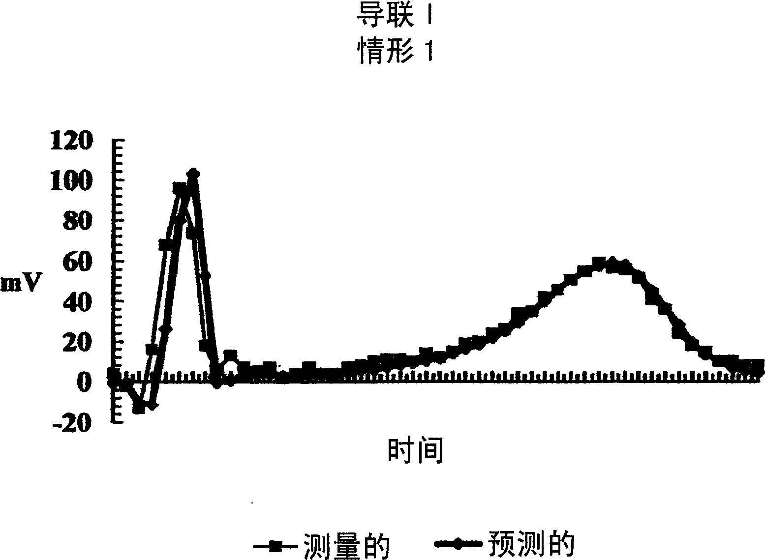 System and method for synthesizing leads of an electrocardiogram