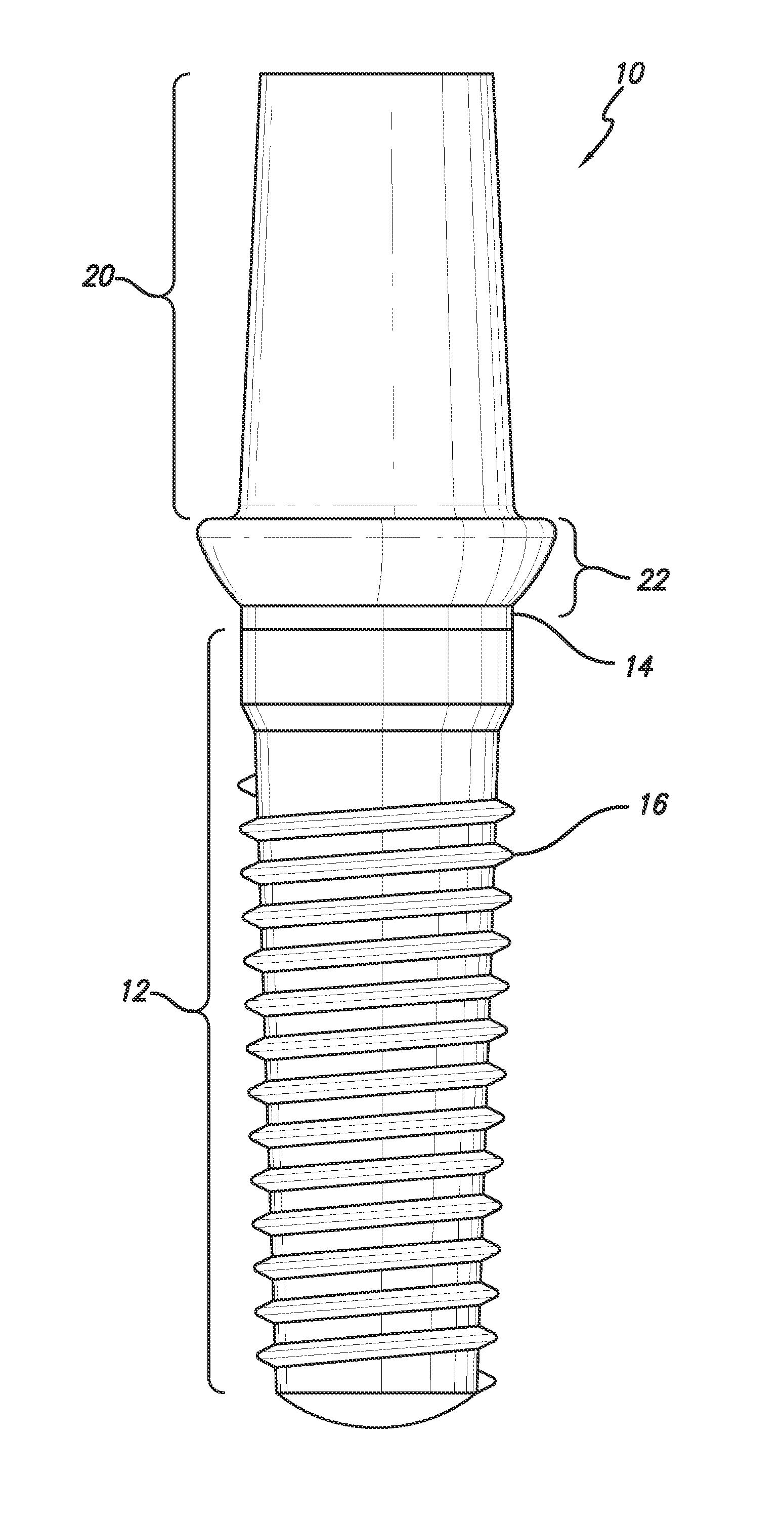 Drug alluding dental implant