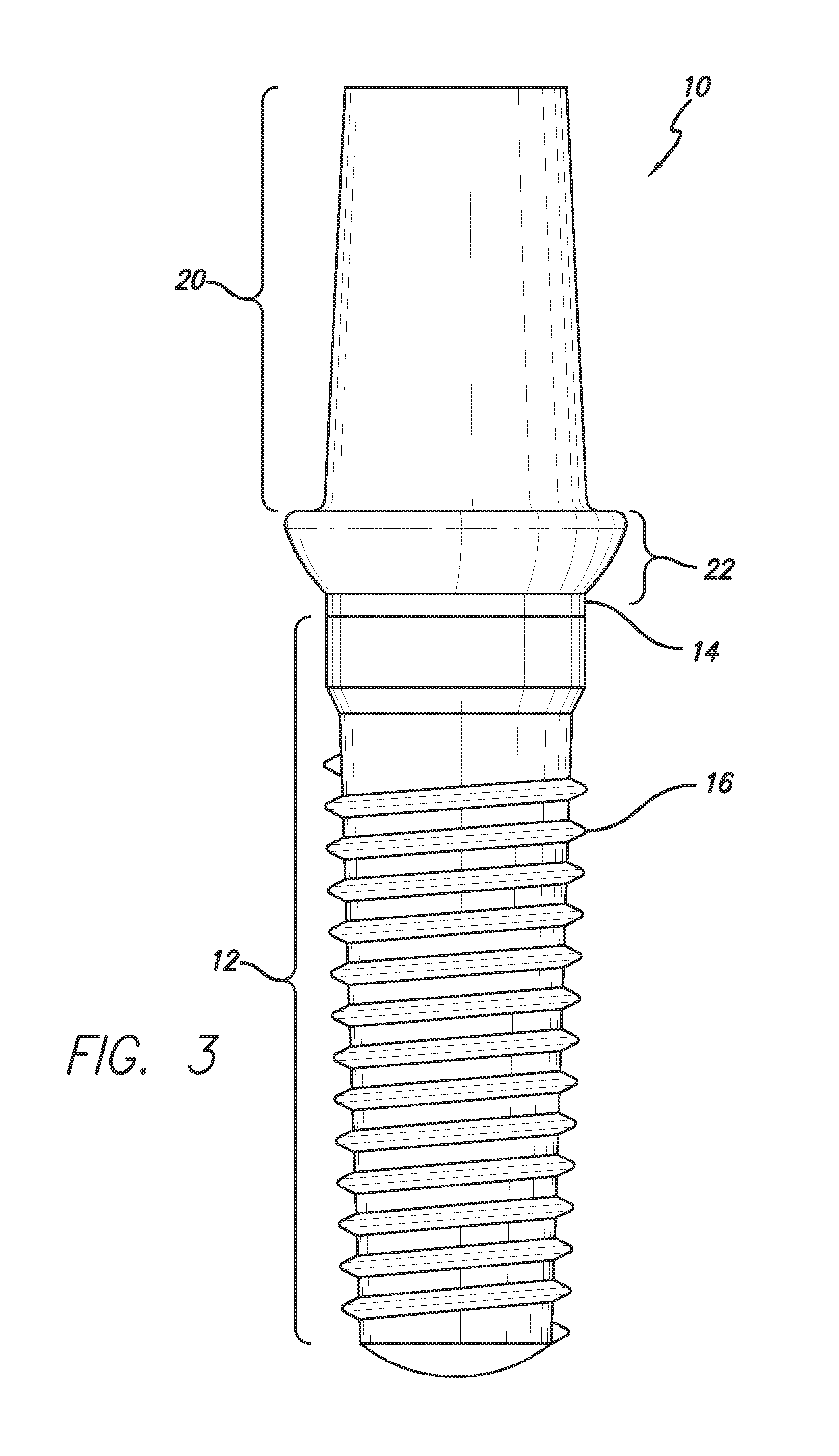 Drug alluding dental implant