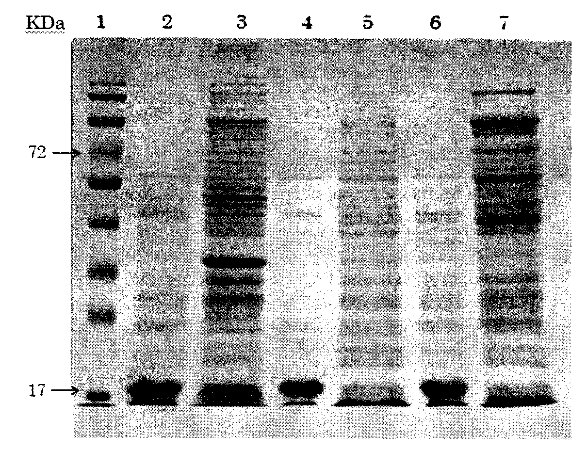 Preparation method for human thymosin beta 4 two-string body protein