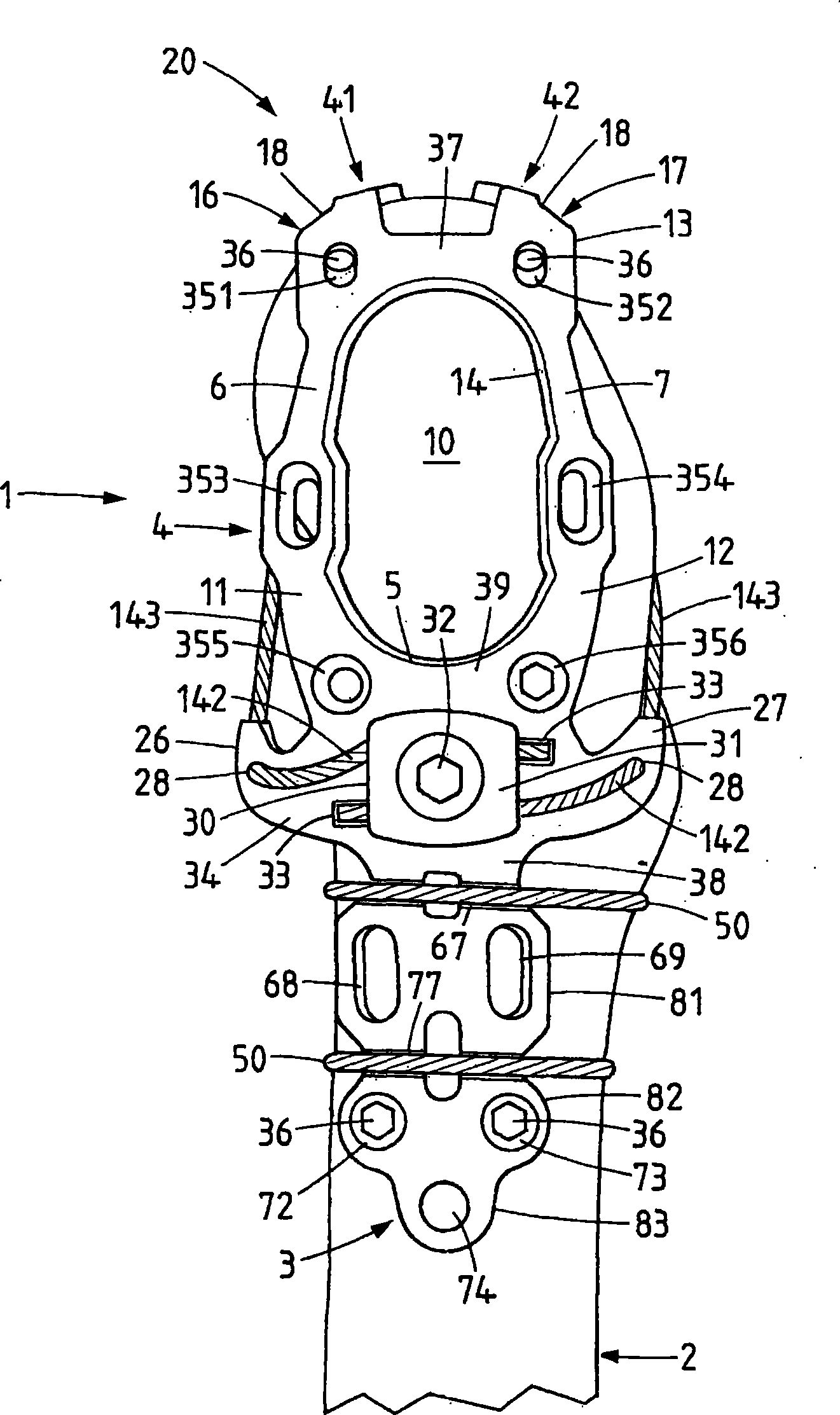 Trochanter retention plate