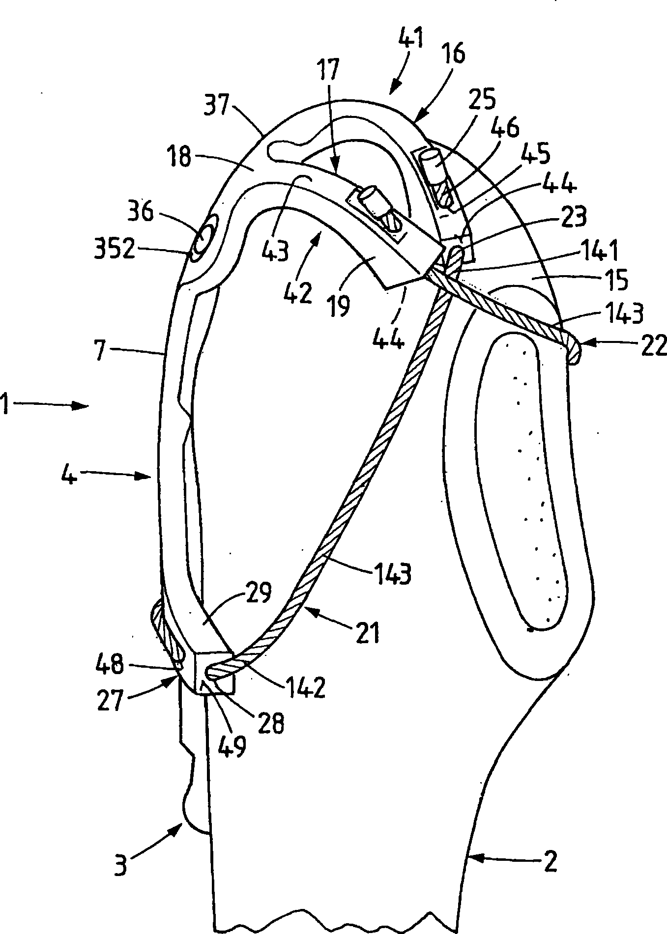 Trochanter retention plate