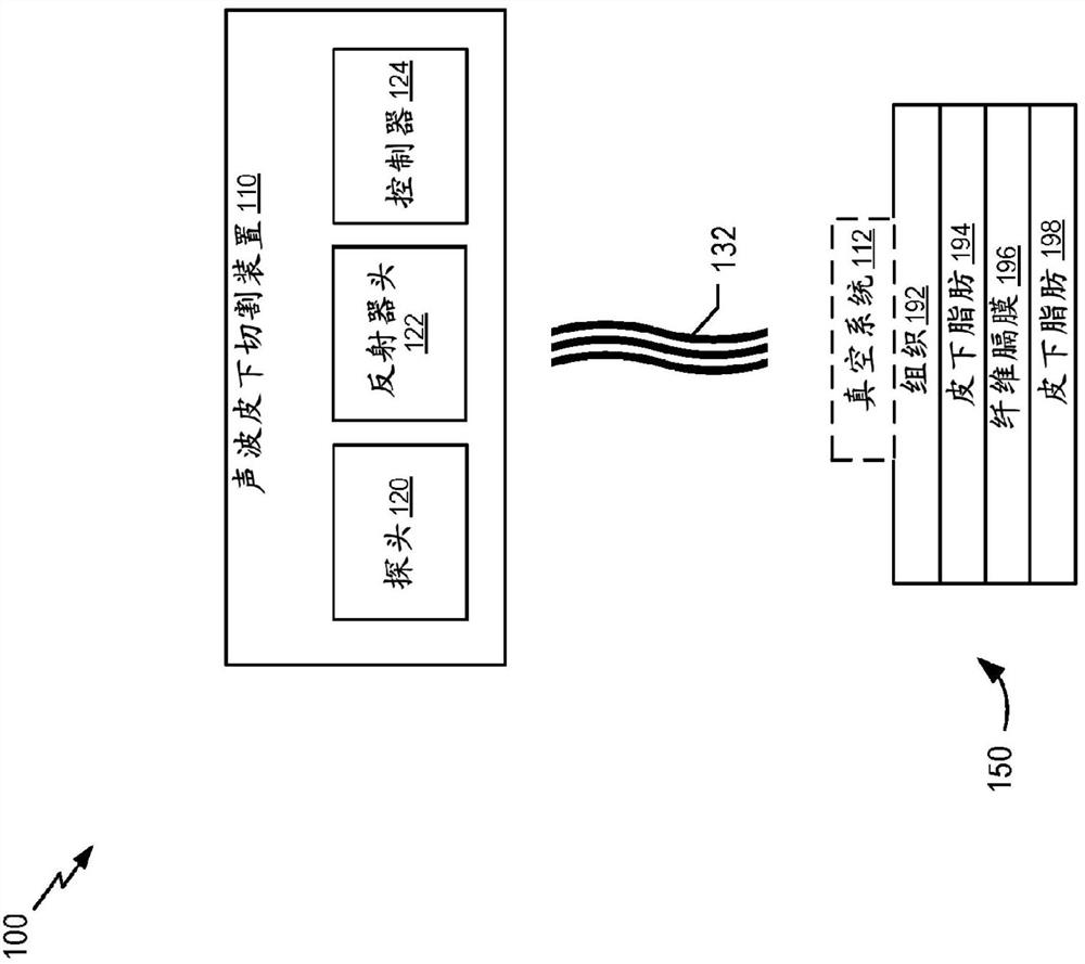 Systems, devices, and methods of treating tissue and cellulite by non-invasive acoustic subcision