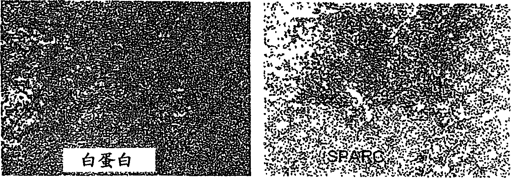 Q3 sparc deletion mutant and uses thereof