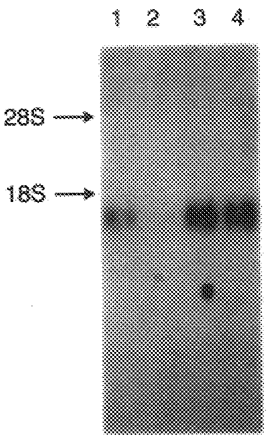 Doc tumor suppressor protein and gene