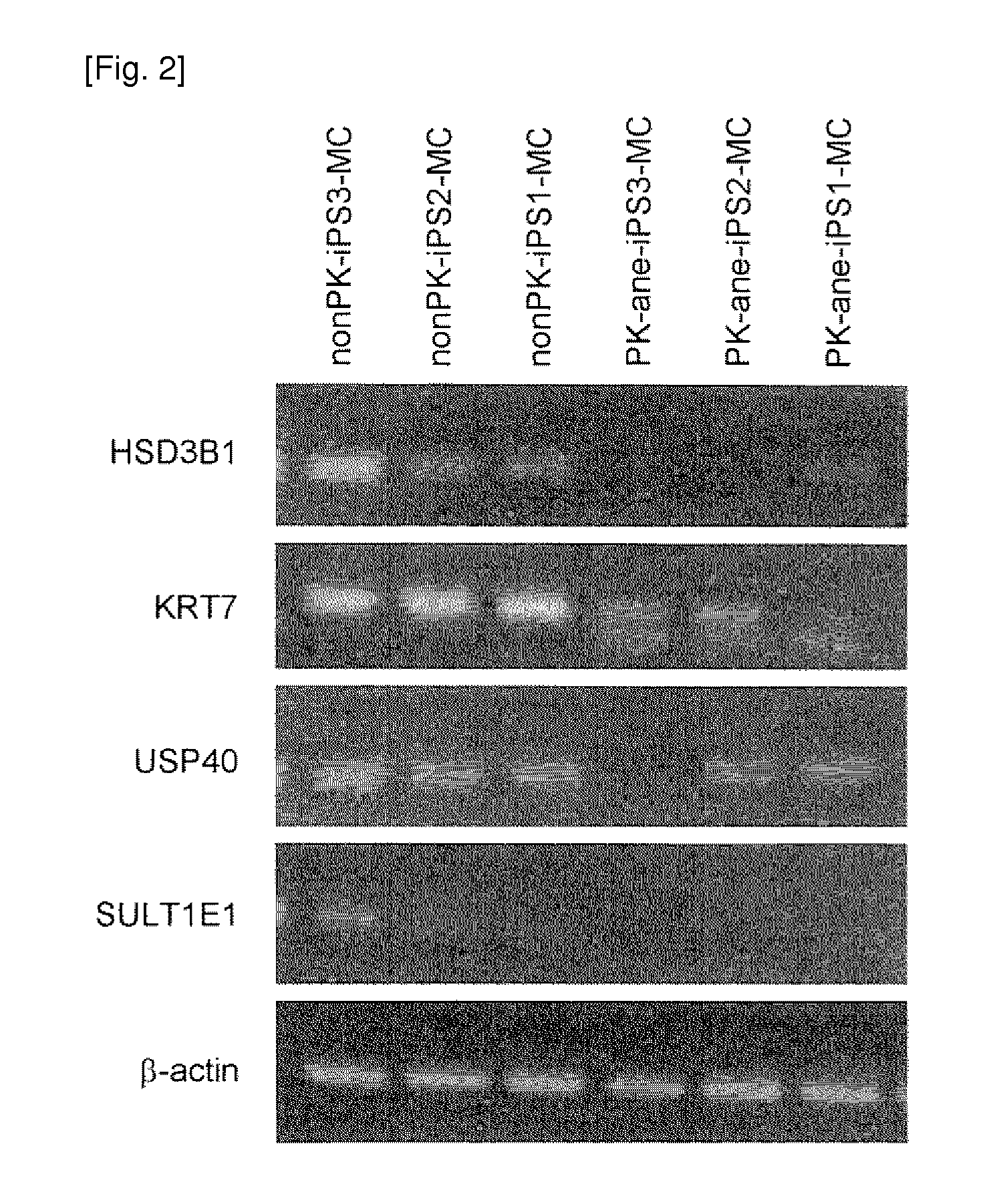 Method of examining polycystic kidney disease and method of screening for therapeutic agent of the disease