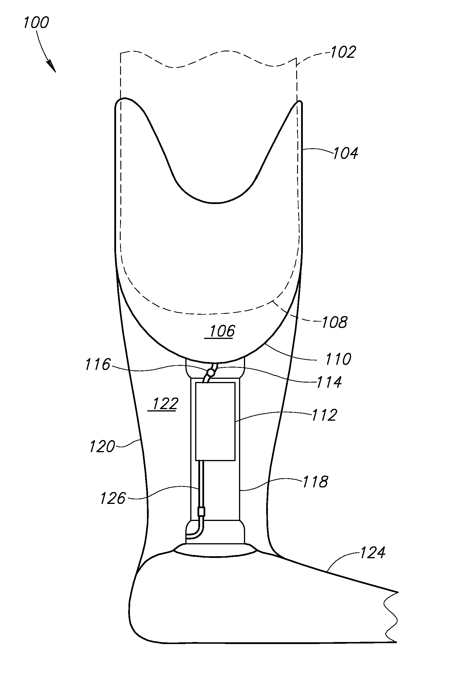 Control system for prosthesis