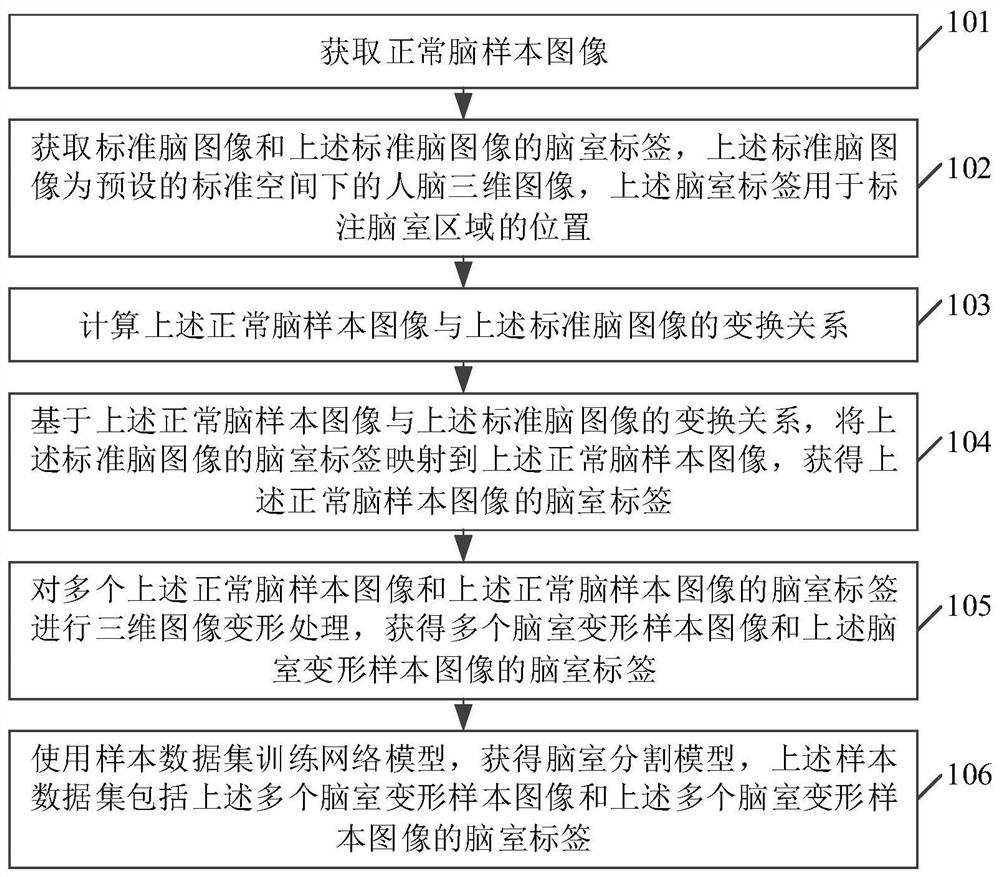 Training method and device for improving ventricular segmentation model, electronic equipment and medium