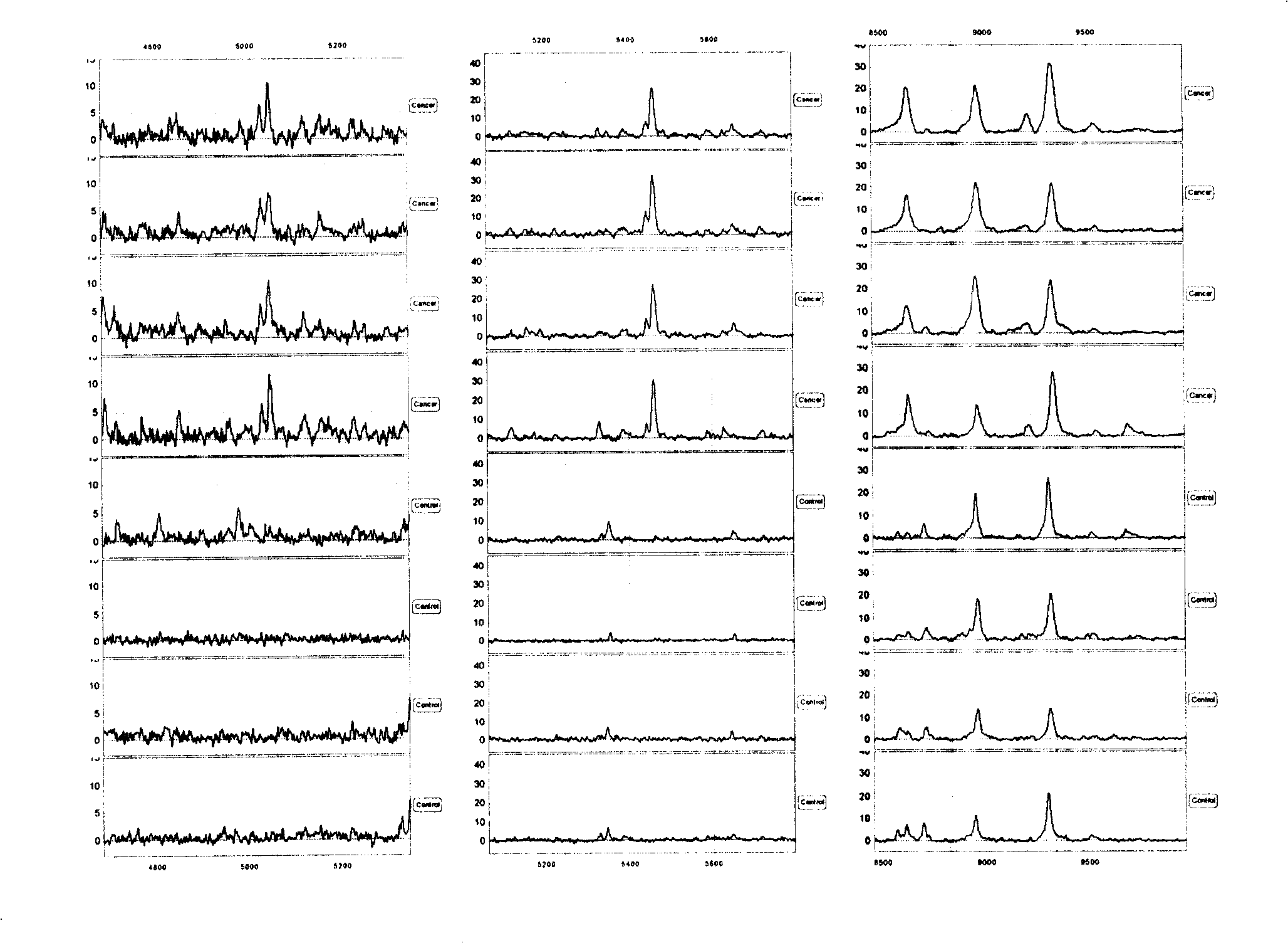 Mass spectrum reagent kit and method for detecting and prognosis judging CEA negative gastric cancer