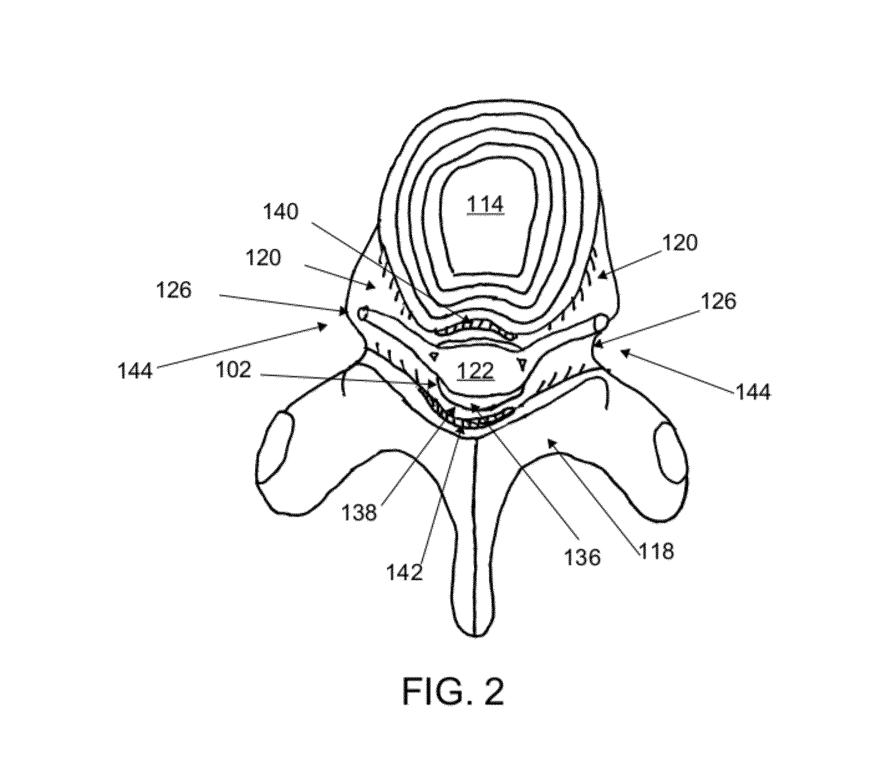 Cannulotome