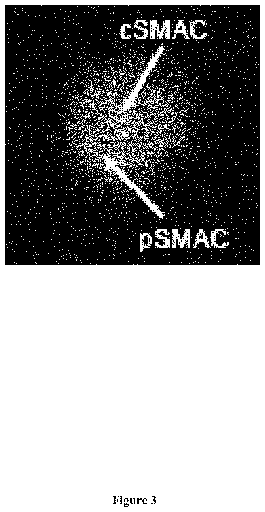 Vasoactive intestinal peptide release from microparticles