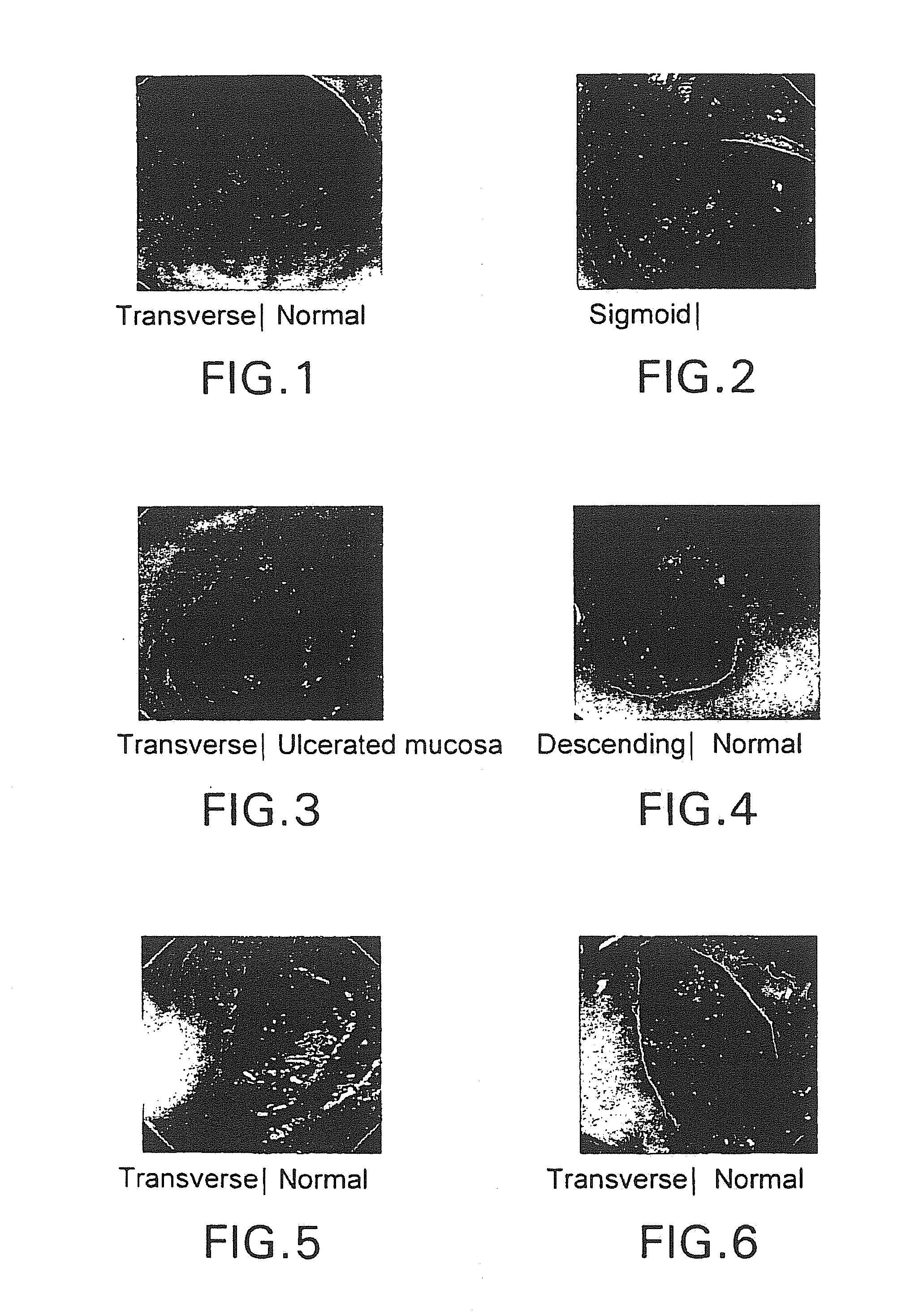 Bowel cleansing composition