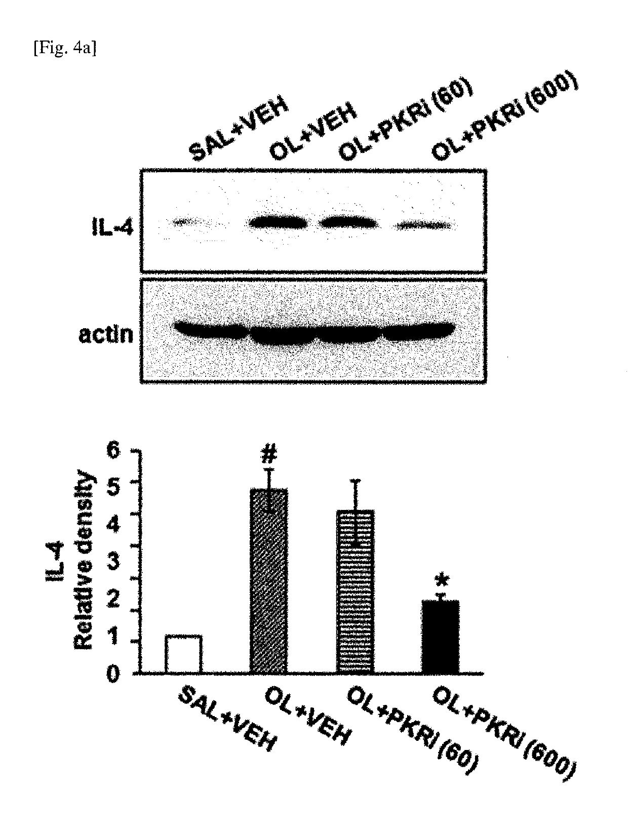 Composition for prevention or treatment of bronchial asthma comprising PKR inhibitor as active ingredient