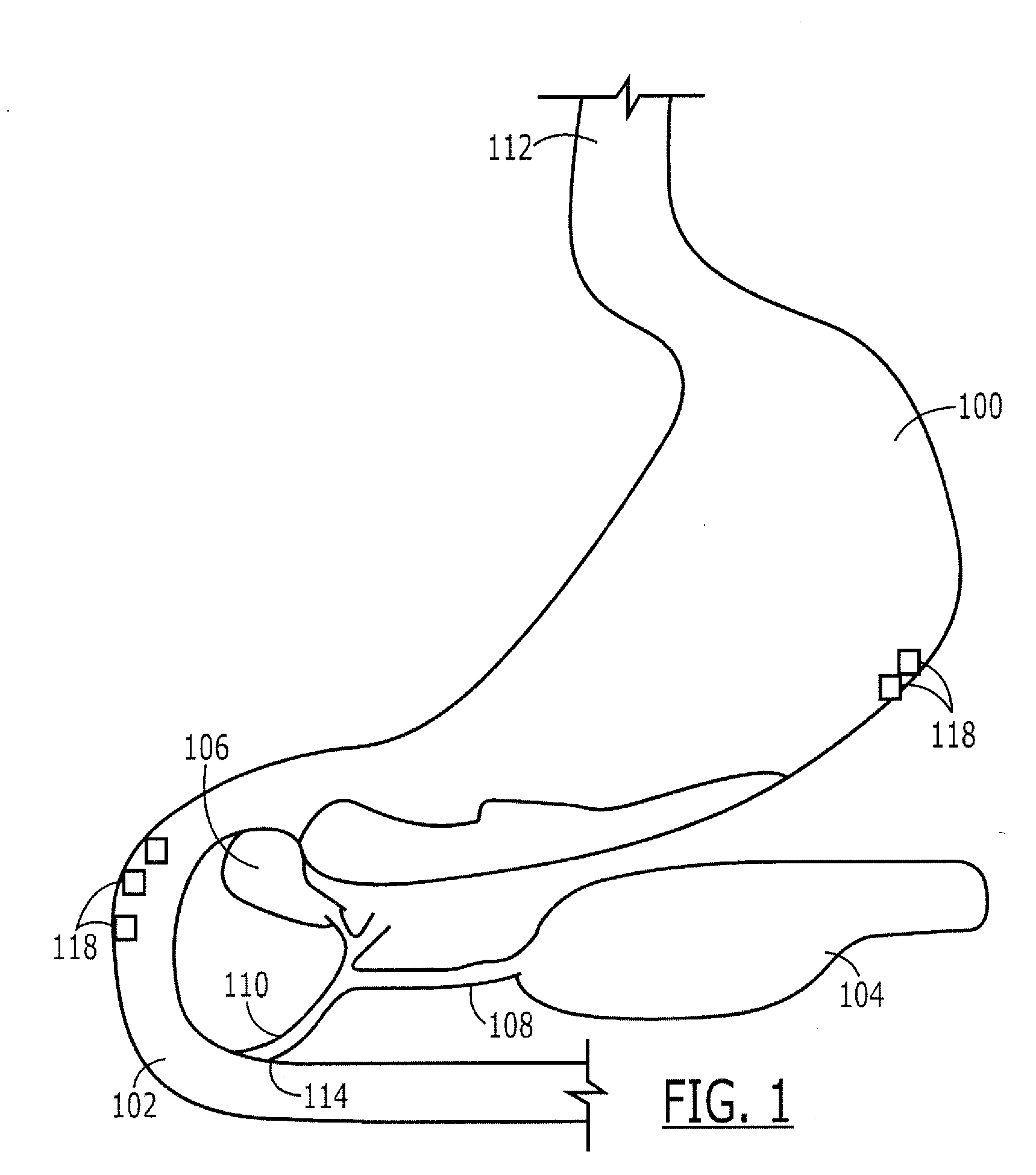 Targeted Therapeutic Agent Release for Weight Loss Therapy